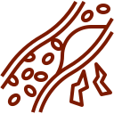 “Medical illustration showing a blood vessel with cholesterol buildup along the artery walls to represent high cholesterol and cardiovascular risk. Image used by a medical clinic in San Bernardino to explain cholesterol related conditions and heart health education